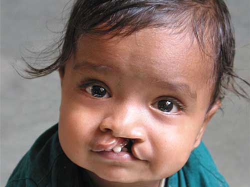 Healing Smile Foundation