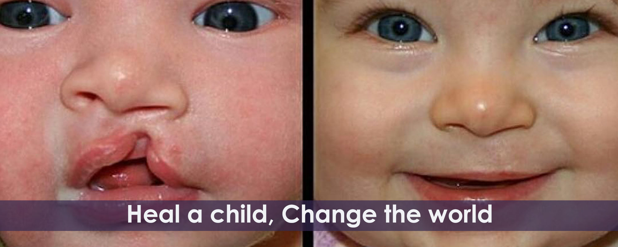Healing Smile Foundation